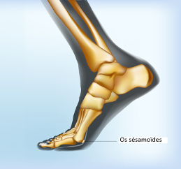 Image de l'os Sesamoides